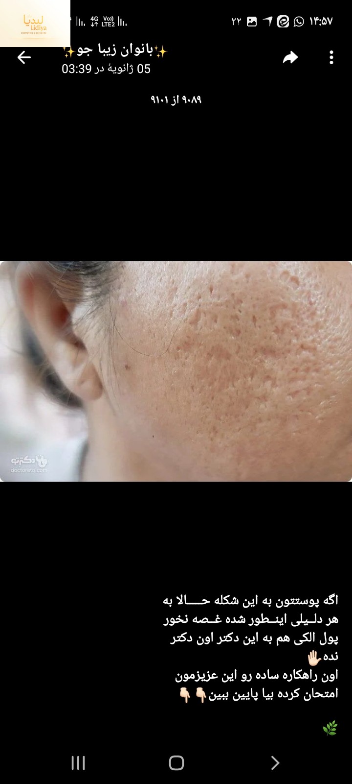 کرم ترمیم کننده جای جوش و زخم و بخیه مرهم اعجاز 30 میل   🌈حاوی خاویار حلزون وکشته مروارید(اشانتیون کرم کلاژن ساز قوی 40 میل  )